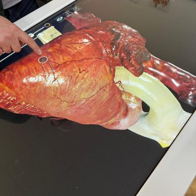 Anatomage 12